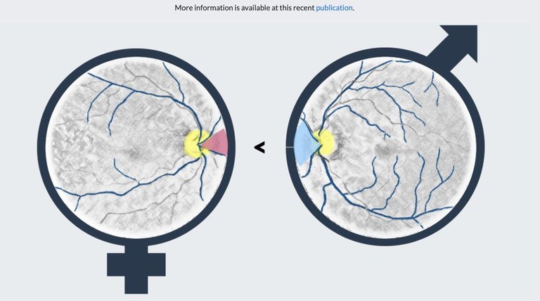 slider_fundus2gender.jpg slider_fundus2gender.jpg