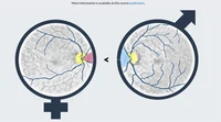 slider_fundus2gender.jpg